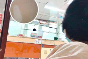 复方卡力孜然酊用什么灯照射