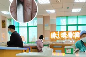 阿法诺肽香港上市了吗最新消息