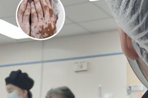 怎么从兰州汽车东站到兰州中研白癜风医院
