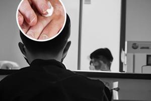 兰州中研白癜风看白癜风查询