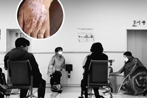 兰州中研白癜风医院位置在这
