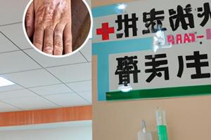 兰州中研白殿风医院是正规的吗