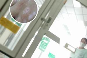 强的松片功效