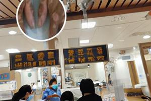 阿法诺肽植入剂怎么用最好的方法是什么检查