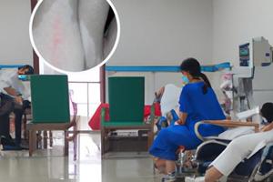 兰州中研白颠疯医院星期六看病吗