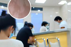 兰州中研皮肤病医院不错