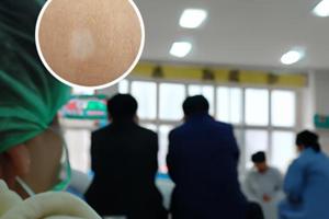 兰州中研医院有哪位朋友知道治白癜风怎么样