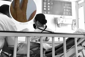 兰州中研白斑医院医生