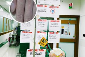 兰州白斑医院评价如何样