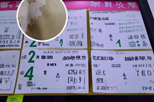 去兰州中研白癜风医院的路线
