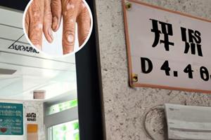 兰州中研白癫风医院治什么病