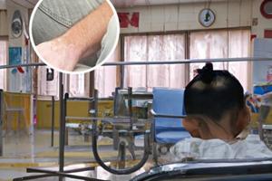 兰州中研白殿风医院的治疗方法