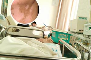 兰州中研白癜风医院怎么走