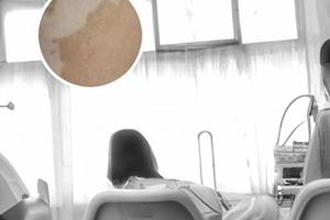 兰州中研医院治疗颈部白斑