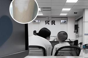 卡力孜然酊效果如何