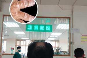 兰州中研医院好吗