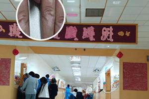 兰州中研白癜风医院医生名单