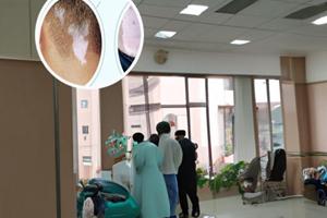 甘肃白斑医院怎么样