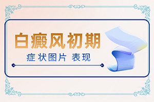 脚上有很多白颠请问买什么药膏能擦好