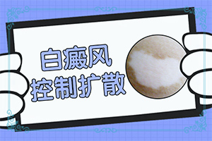 脖子上长白颠十年没有发展擦什么药会好