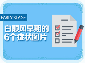 为什么男性白点癫风治疗却没有好转
