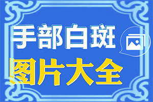 晚期手部白颠疯病怎么治疗的好