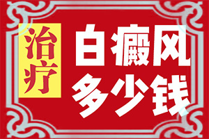 白点癫风擦什么药最好