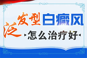 白屑风能治好吗白颠风不治疗会怎么样