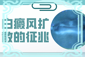 儿子脸上看上去老有白殿怎么回事
