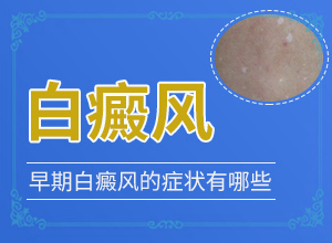 白斑和白点癫风的图片区别好治吗