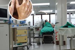 他克莫司治疗白斑效果白白论坛