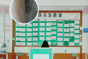 兰州中研医院是正规医院吗多少钱