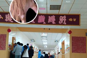 兰州中研白癜风医院手机号码