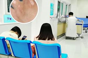 兰州中研医院白癜风好评