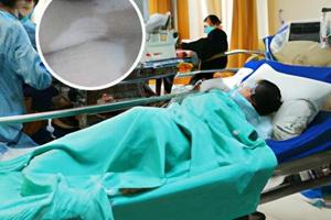 兰州中研白癜风医院怎么样好吗