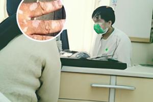 甲泼尼龙24小时过药效了吗