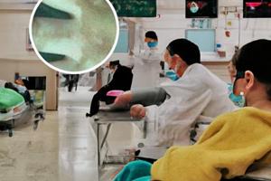 白癜风患者光疗后的效果图