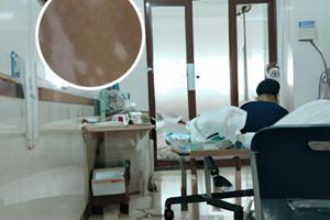 光疗颜色的作用是什么