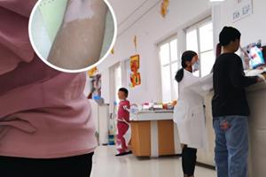 莫匹罗星软膏治疗什么病