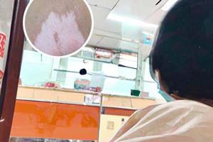 白癜风光疗仪哪个牌子的好