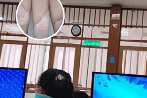 阿法诺肽植入剂上市了吗多少钱一盒啊