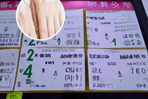 白癜风光疗恢复全过程