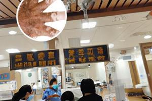 甲泼尼龙封闭配比