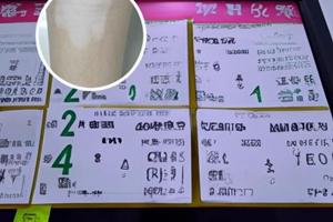 复方卡力孜然酊哪些药店有卖