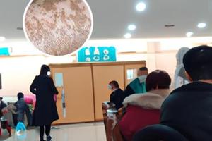 阿法诺肽中国上市了吗知乎全文