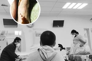 卤米松乳膏和新适的确区别