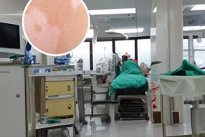 艾洛松软膏是激素吗