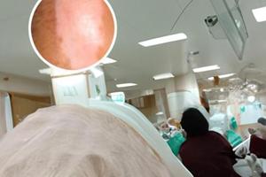 白癜风光疗恢复全过程视频