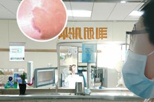 阿法诺肽植入剂上市了吗多少钱一瓶啊