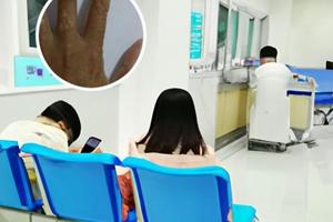 皮肤ct比伍德灯更准确吗
